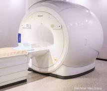 Pemanfaatan AI sistem CT Scan