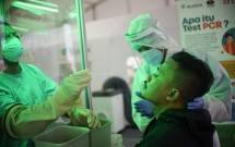 Tidak Sama, Dokter Yurianto: COVID-19 di Indonesia Tidak Bisa Dibanding-bandingkan Dengan Negara Lain