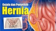 Hernia (Ist) 