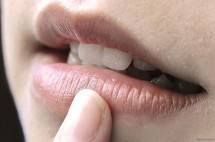 Penyebab Bibir Menghitam (Ist)