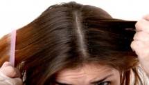 Rambut Berketombe (Ist)