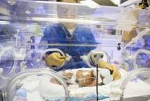 Pemerintah Indonesia telah mengambil langkah penting untuk mencegah stunting akibat malnutrisi untuk para bayi yang lahir prematur ataupun Berat Badan Lahir Rendah (BBLR) dan anak dengan kelainan metabolik langka dengan mengeluarkan Keputusan Menteri Kesehatan Nomor HK.01.07/Menkes/2197/2023 tentang Formularium Nasional.